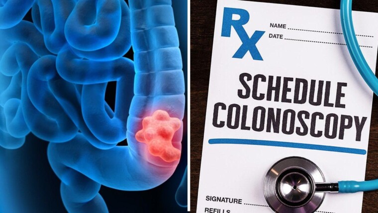 Health expert, citing ‘grave concern,’ says results of new colonoscopy study are ‘wildly’ misinterpreted